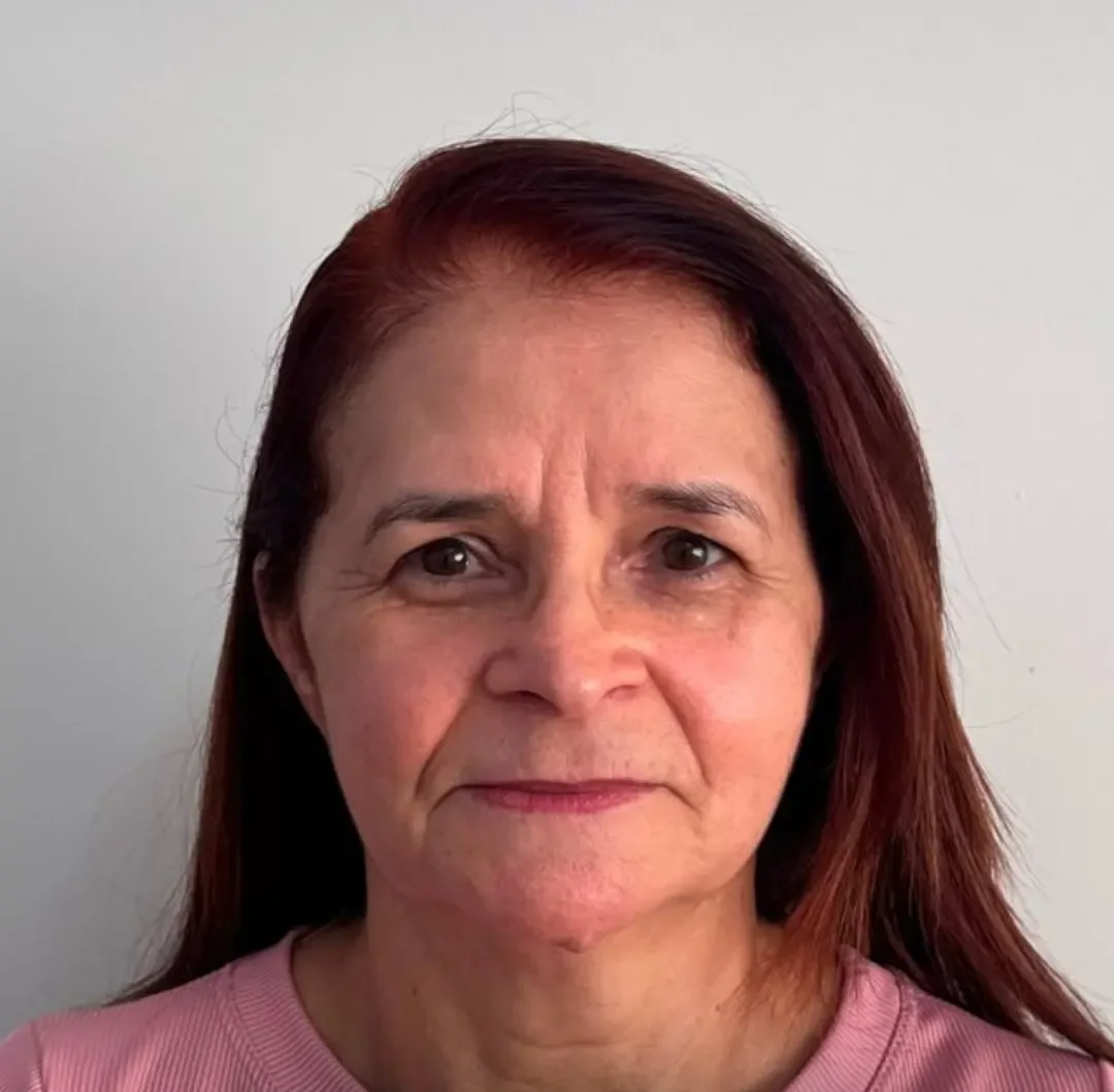 Antes: paciente de frente