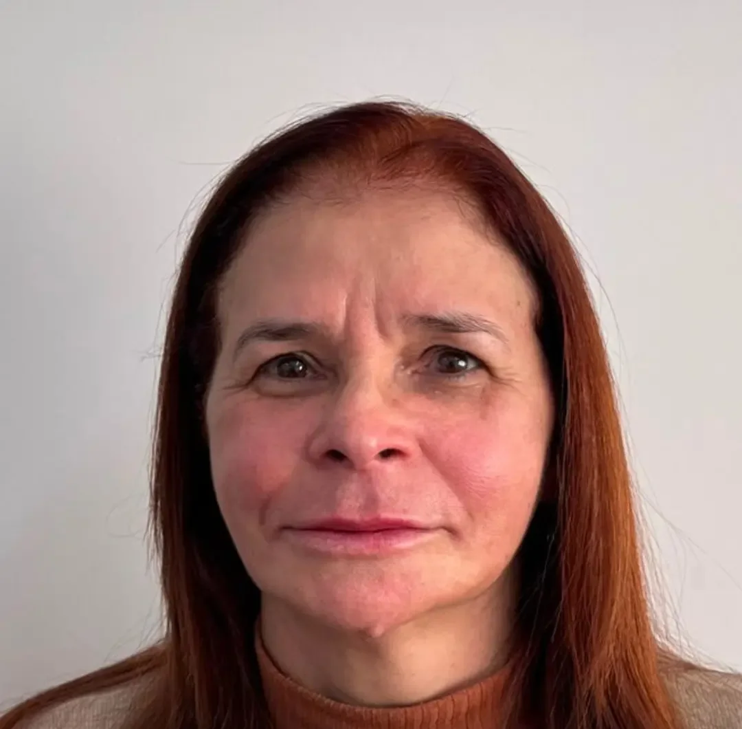 Depois: a mesma paciente de frente, após a harmonização facial